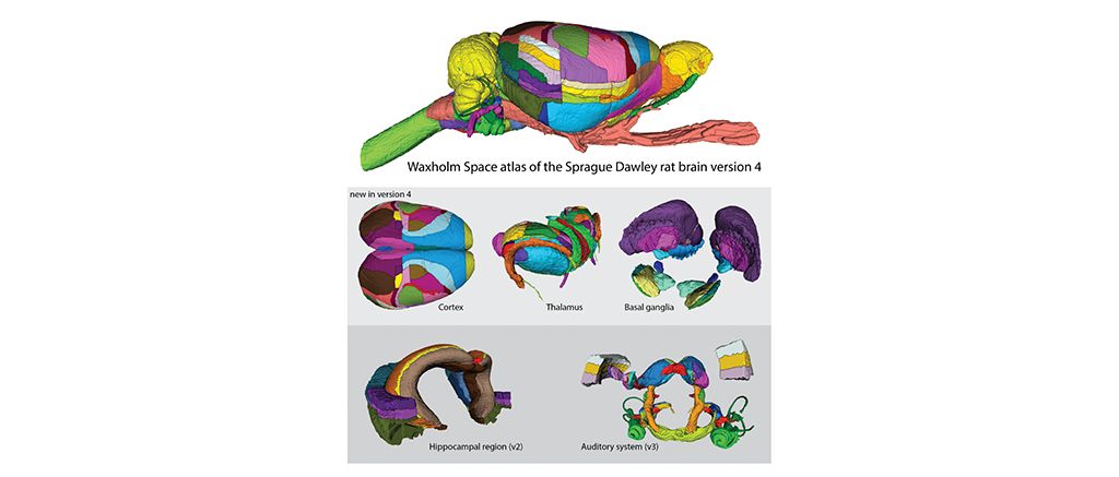 Volumetric rat brain atlas on EBRAINS now covers entire brain