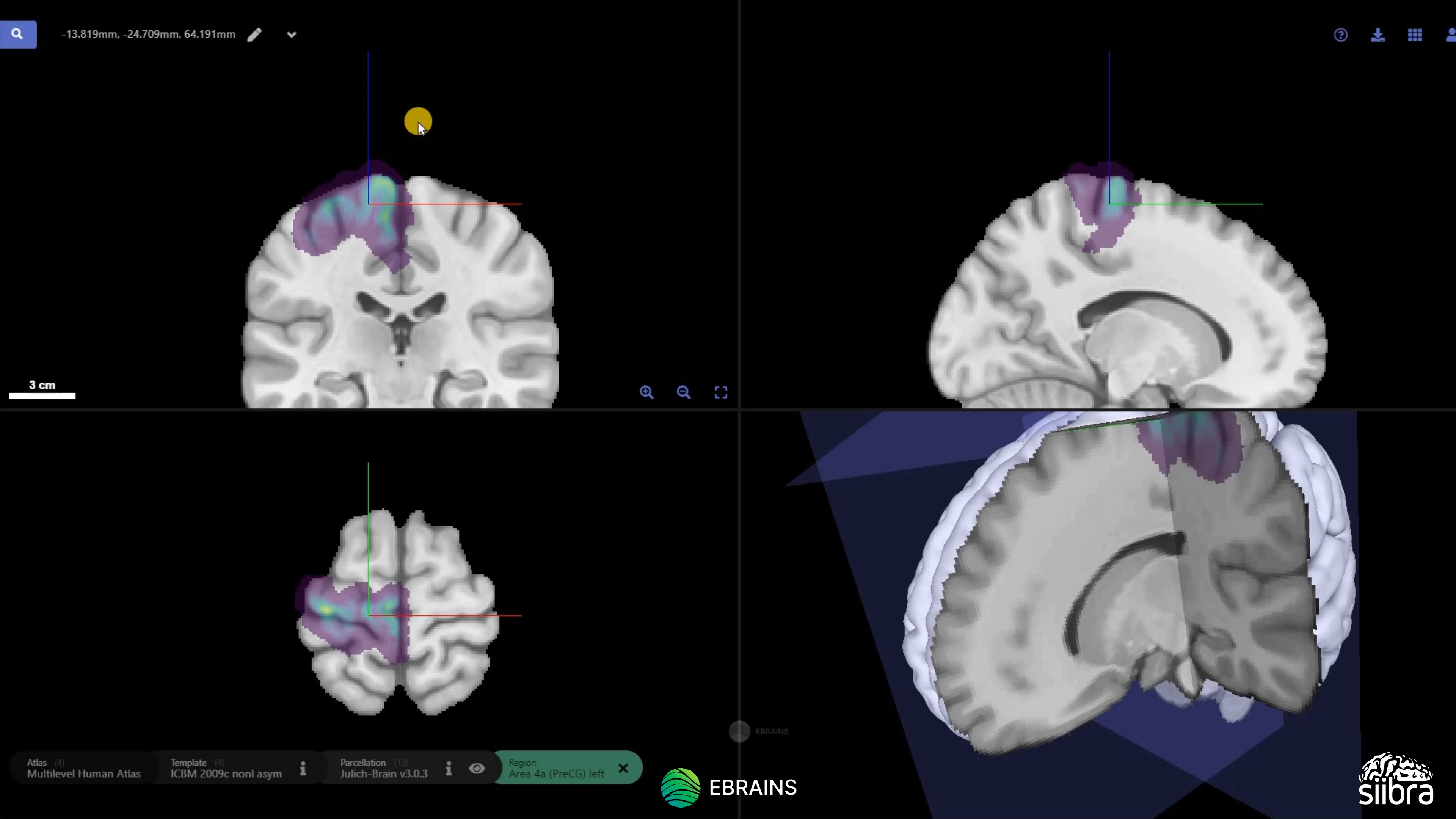 EBRAINS: Europe's Research Infrastructure For Brain Research - EBRAINS