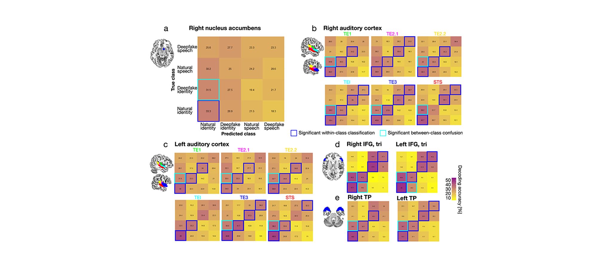 EBRAINS Atlas used in study