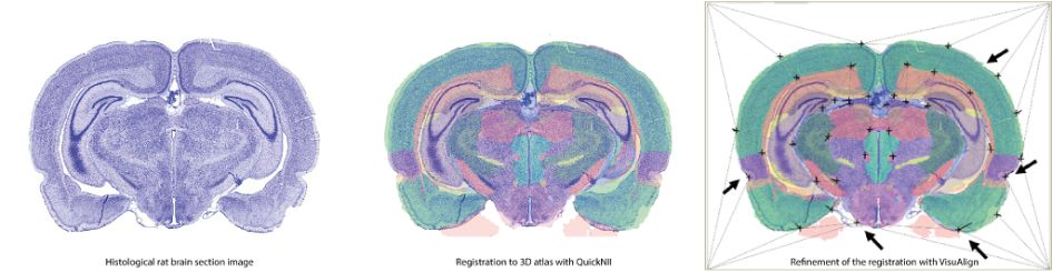 2D section images to 3D atlas