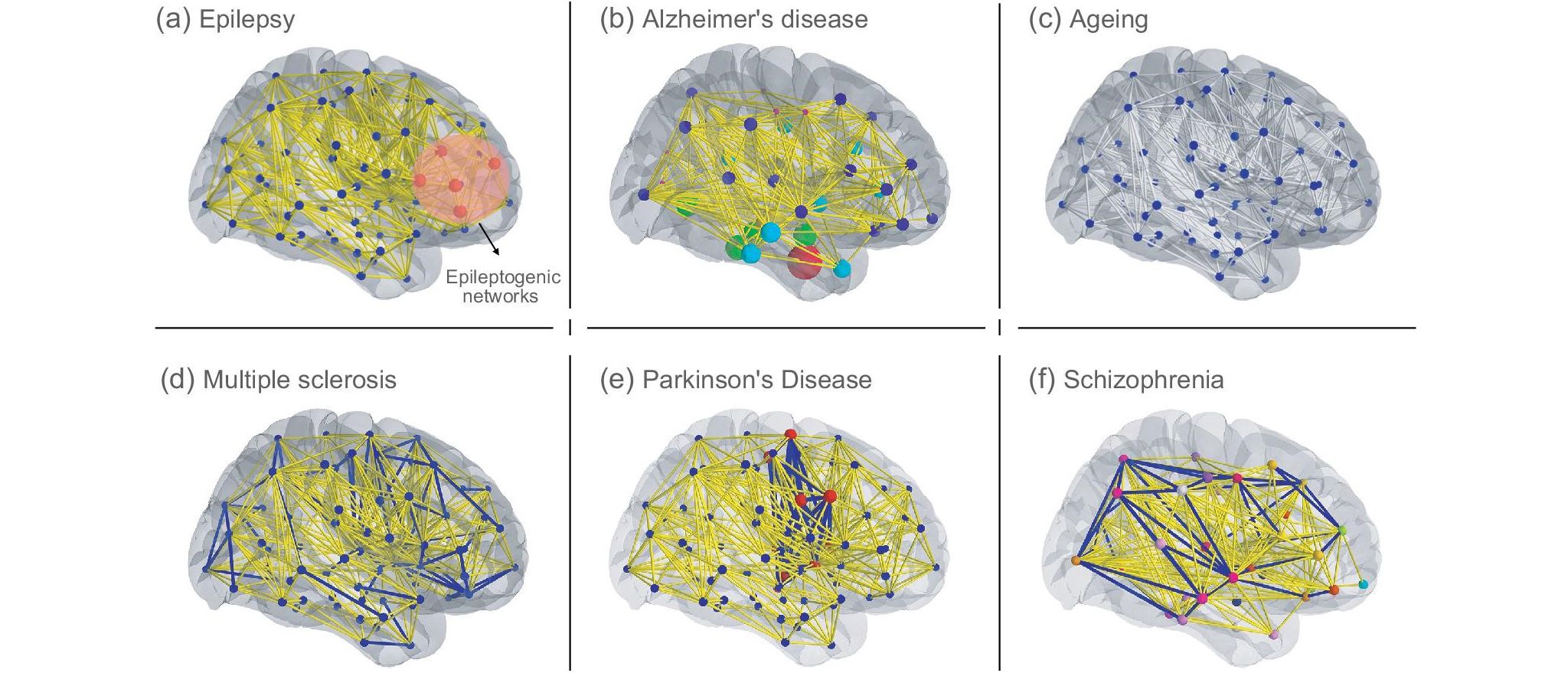 Advancing Neuroscience With Personalised Brain Models