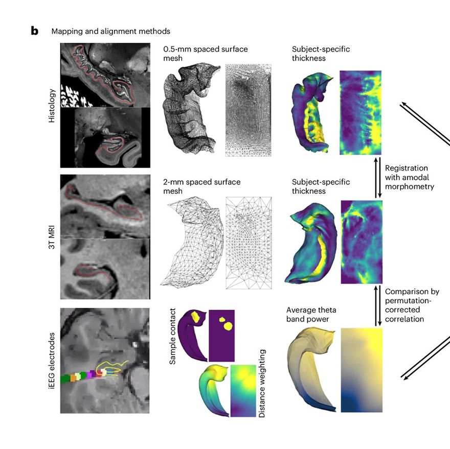 Hippomaps Simplifies Hippocampus Research Image