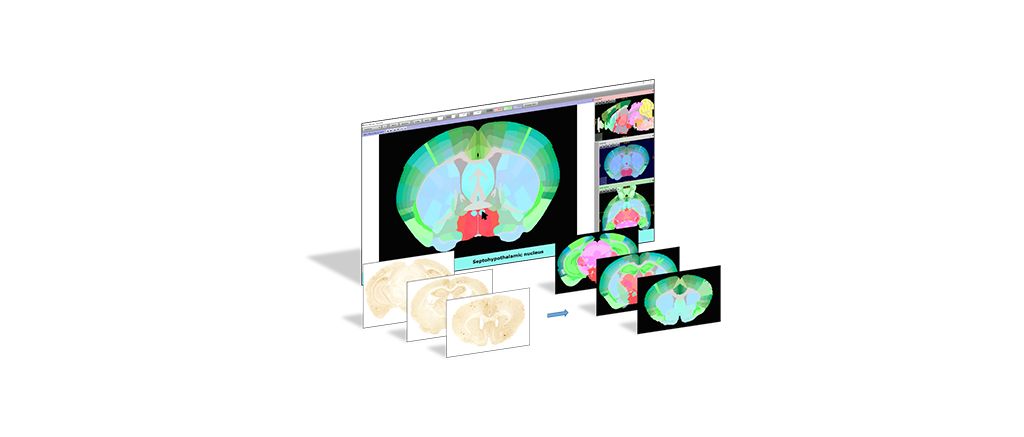 New Unified Mouse atlas from the KIM lab is now available in the EBRAINS QuickNII image registration tool