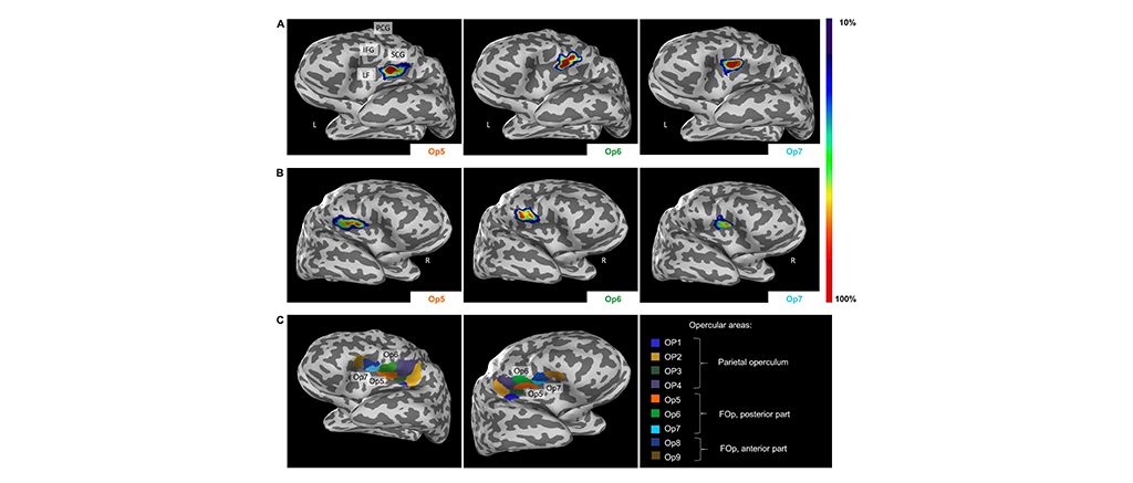 Three Newly Identified Brain Areas Involved In Sexual Sensation Motor Coordination And Music Processing Available On Ebrains Image