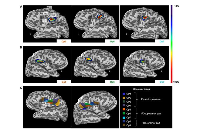 Three Newly Identified Brain Areas Involved In Sexual Sensation Motor Coordination And Music Processing Available On Ebrains Image