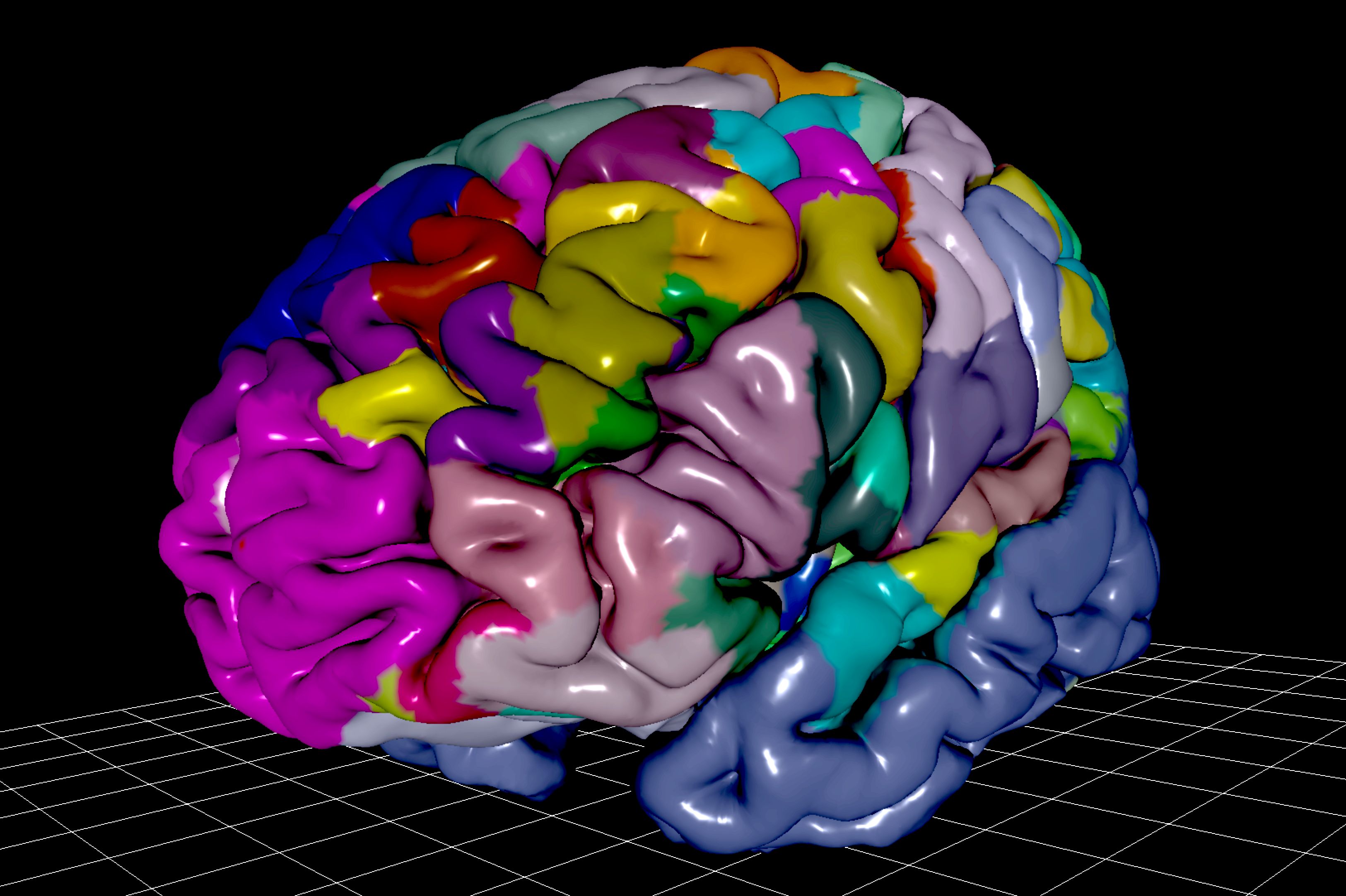 Image of the Julich Brain Atlas