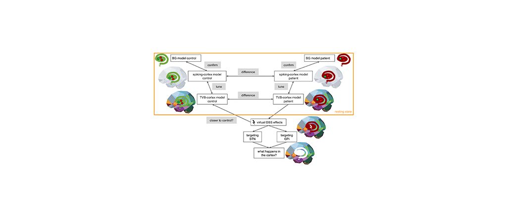 Scientists use EBRAINS to simulate deep brain stimulation in Parkinson’s disease