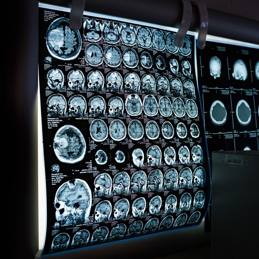 Image of brain scans