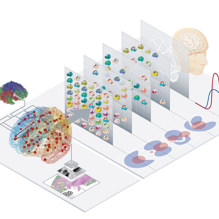 Virtual Ageing Brain Model
