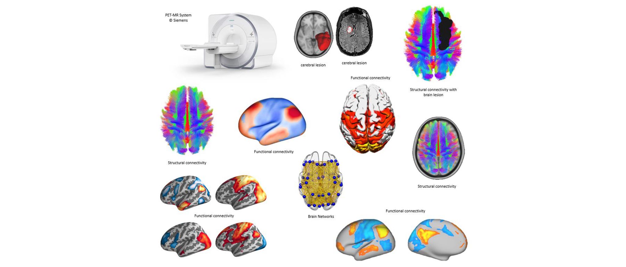 EBRAINS